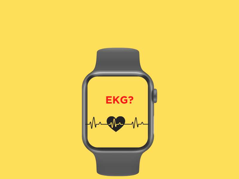 Which Apple Watch has an EKG?
